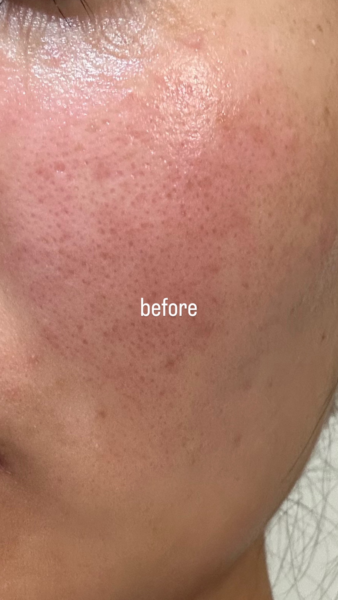 PDRNキューブセラム/DPPR/美容液を使ったクチコミ（2枚目）