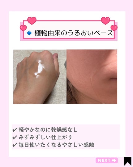 Kana on LIPS 「ゼロカ86トナーを毎日使って1週間✨beforeのときは「どん..」(4枚目)