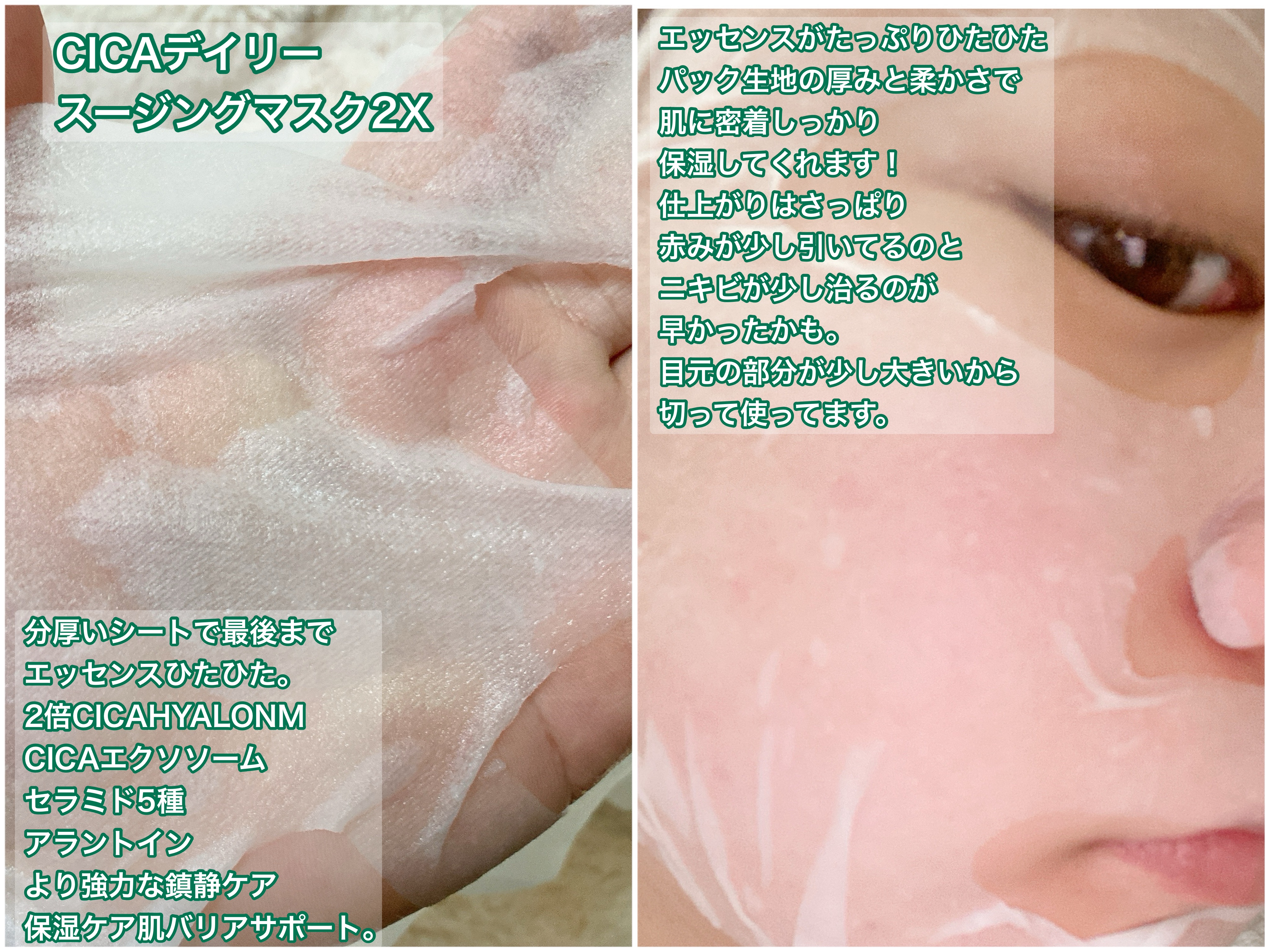 CICA デイリースージングマスク2X/VT/シートマスク・パックを使ったクチコミ（3枚目）