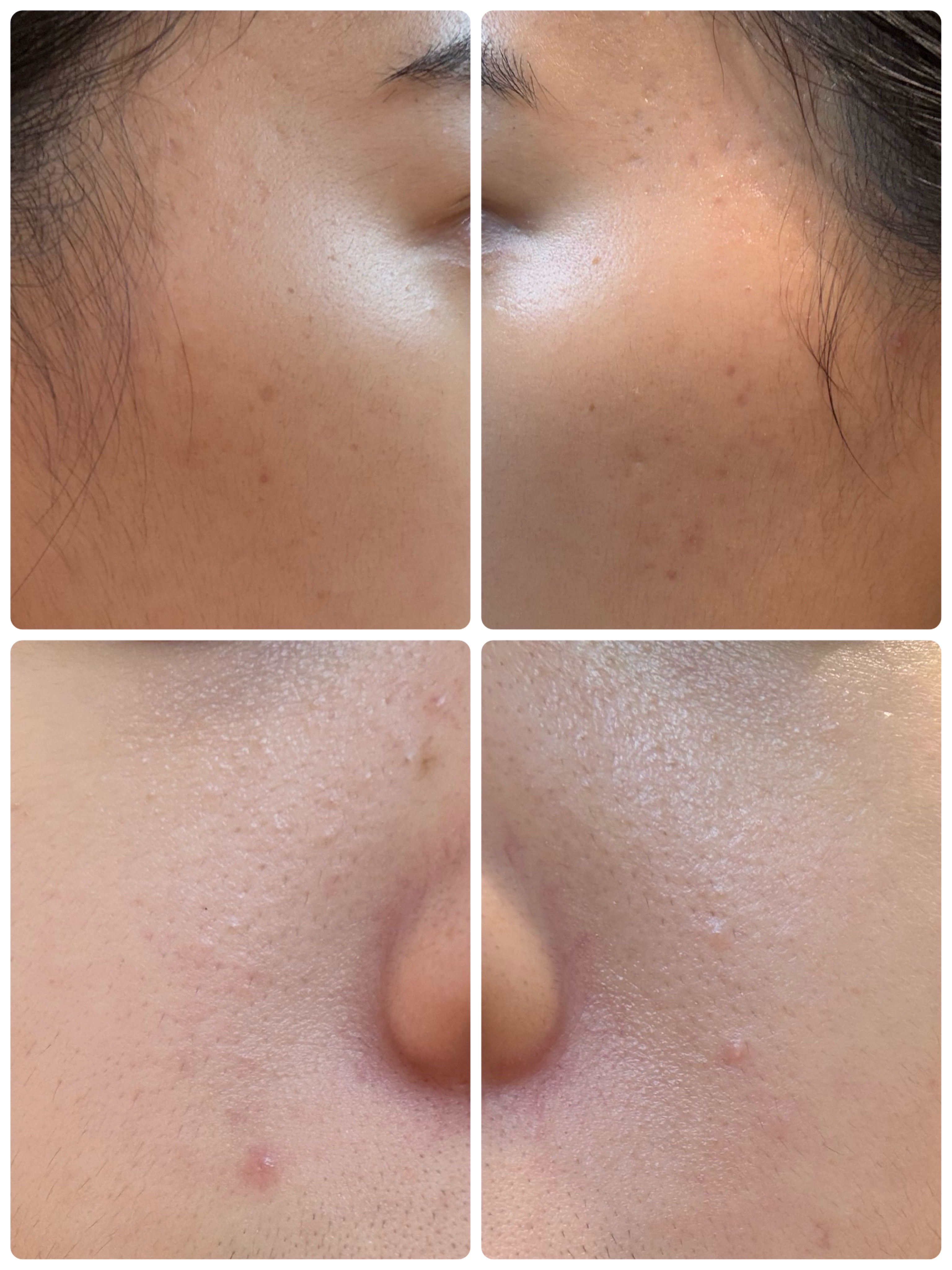 薬用雪肌精 ブライトニング クレンジング オイル[医薬部外品] 150mL/雪肌精/オイルクレンジングを使ったクチコミ（2枚目）