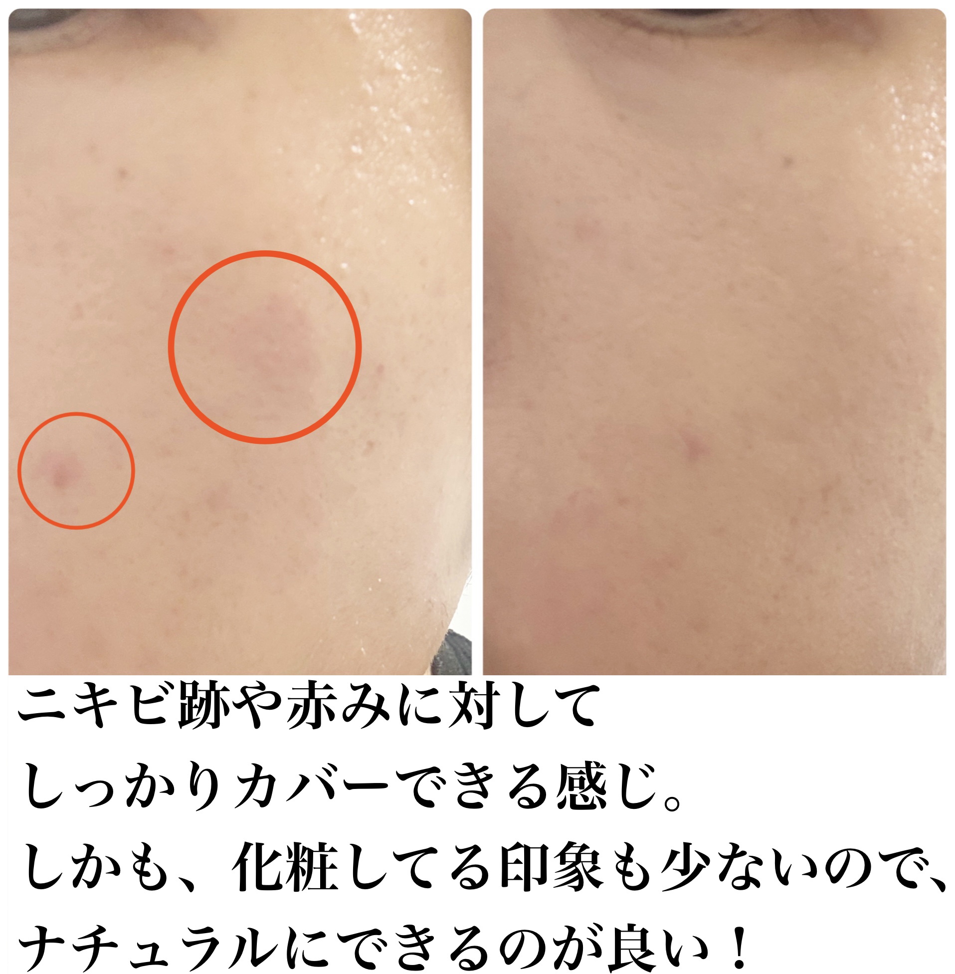 ラディアントクリーミーコンシーラー 1247 CANNELLE/NARS/リキッドコンシーラーを使ったクチコミ（2枚目）