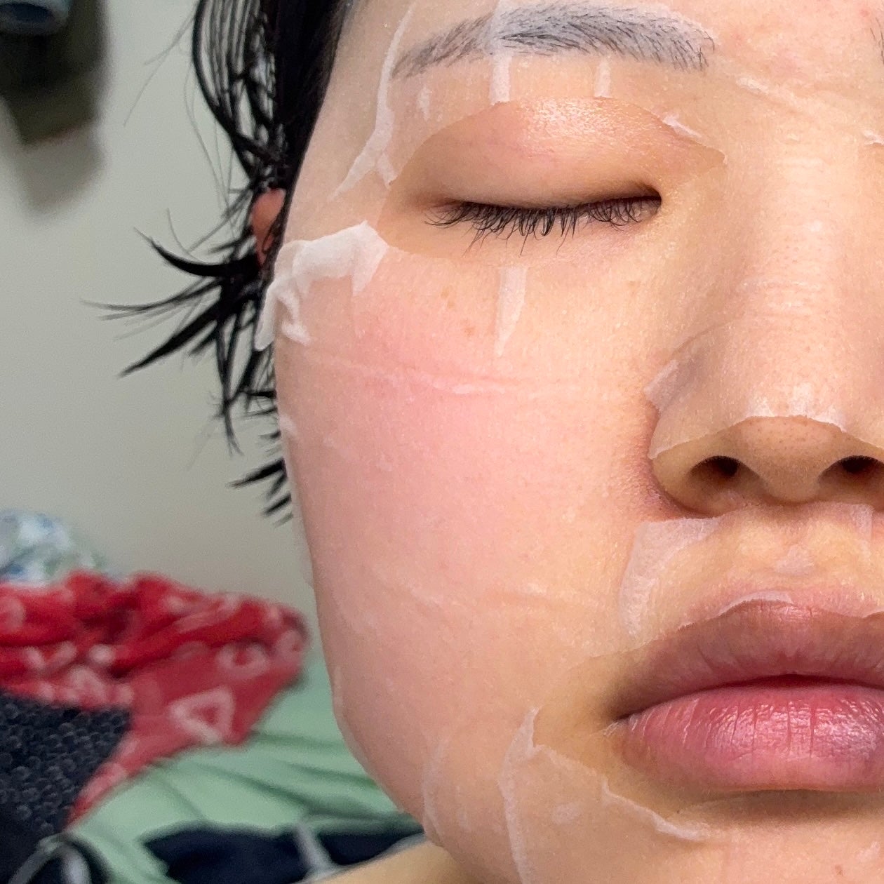 シカレチA エッセンス0.1/VT/美容液を使ったクチコミ(5枚目)