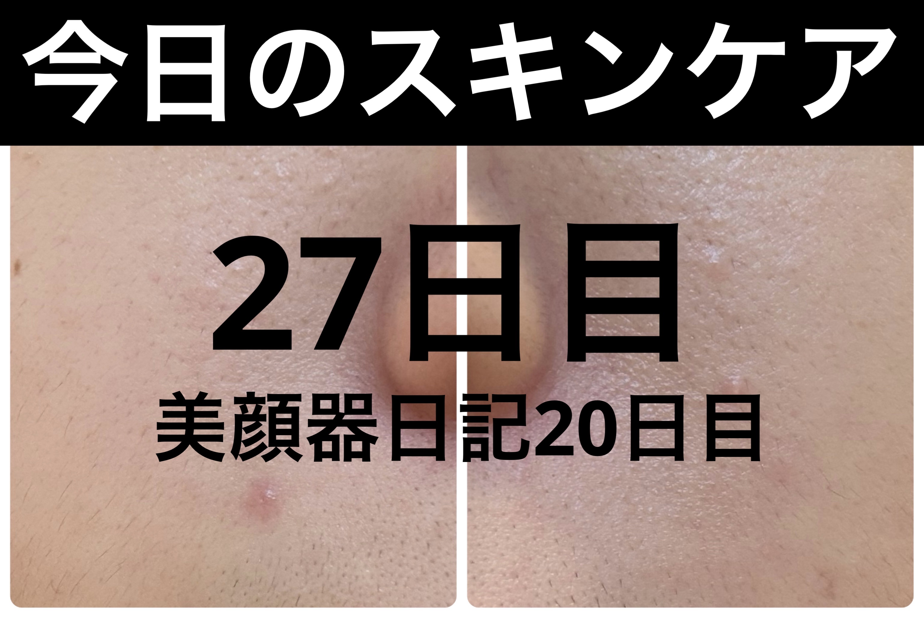 薬用雪肌精 ブライトニング クレンジング オイル[医薬部外品] 150mL/雪肌精/オイルクレンジングを使ったクチコミ（1枚目）