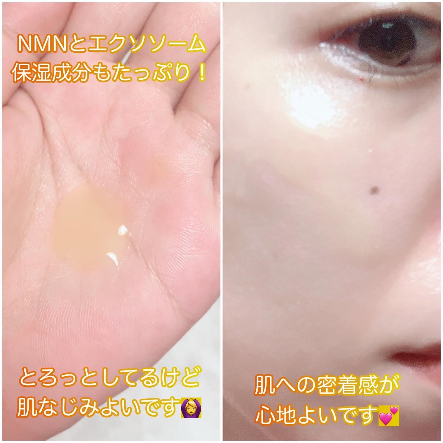 アットクリニック プランピングショット/DOMINAS/美容液を使ったクチコミ(3枚目)