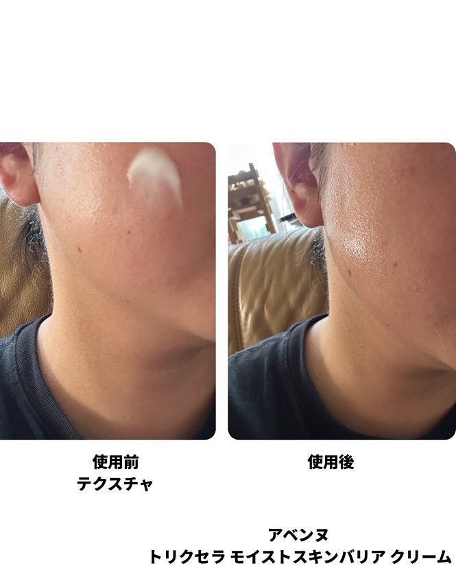 トリクセラ モイストスキンバリア クリーム/アベンヌ/ボディクリームを使ったクチコミ(6枚目)