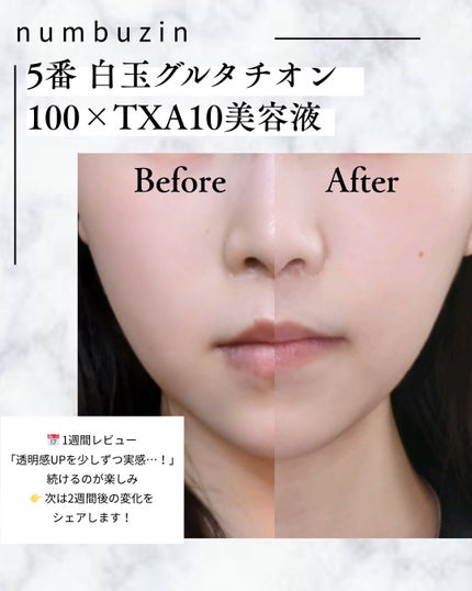 5番 白玉グルタチオン100×TXA10集中トーニング美容液/numbuzin/美容液を使ったクチコミ(4枚目)