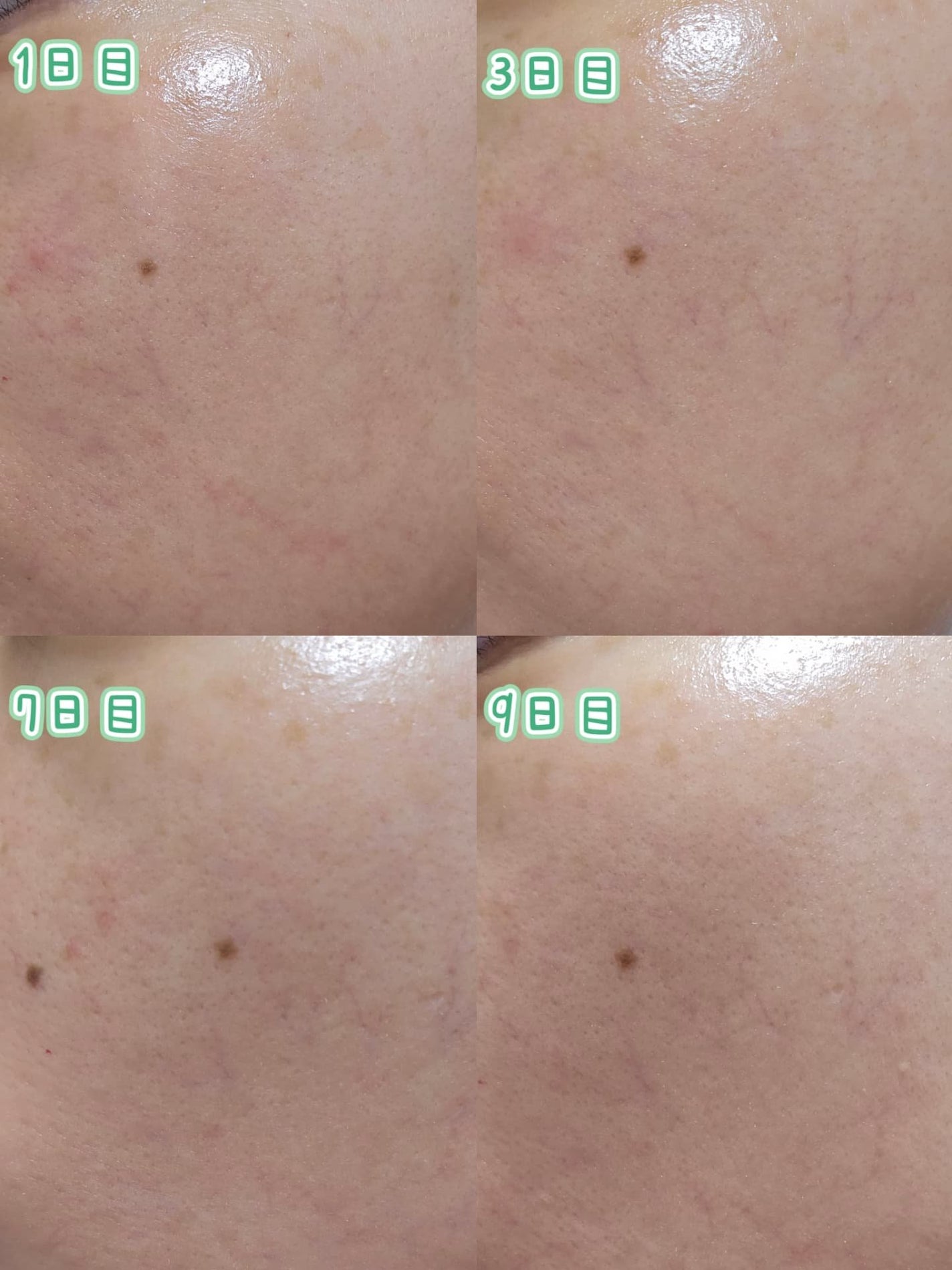 PDRN カプセルクリーム 100/VT/フェイスクリームを使ったクチコミ(3枚目)