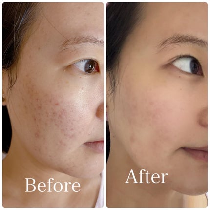 ココチ シートマスク アプデ ブースター/COCOCHI/ブースター・導入液を使ったクチコミ(7枚目)