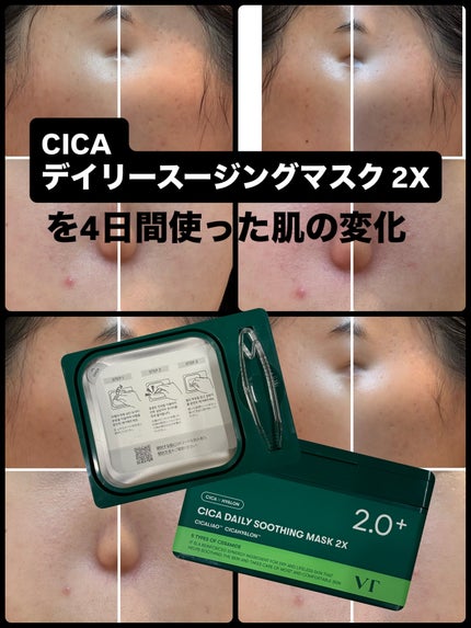 CICA デイリースージングマスク2X/VT/シートマスク・パックを使ったクチコミ(1枚目)