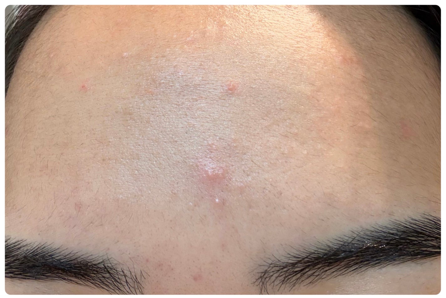 AGE-R ブースタープロ/MEDICUBE/美顔器・マッサージを使ったクチコミ(3枚目)