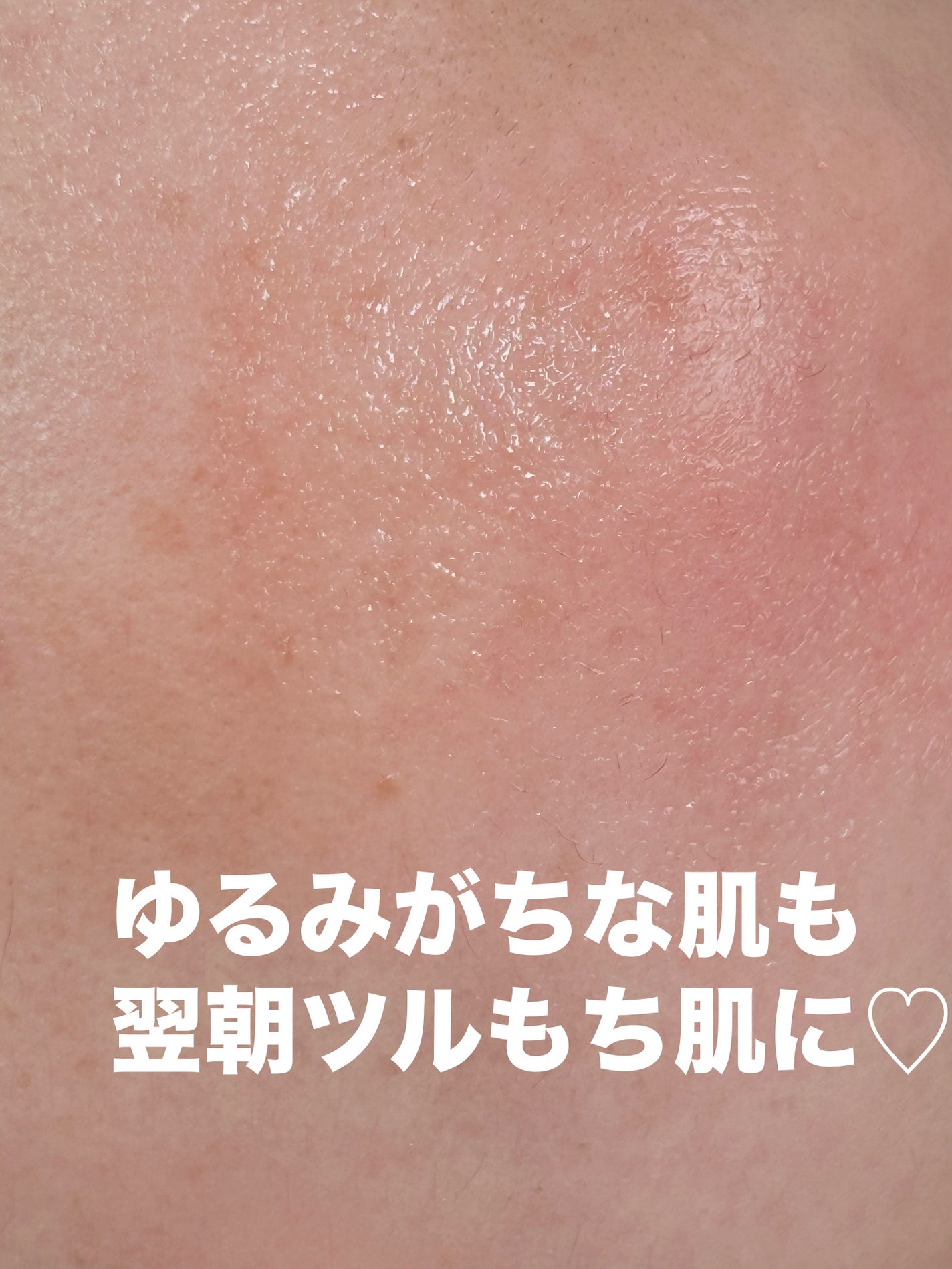 PDRNキューブセラム/DPPR/美容液を使ったクチコミ(5枚目)