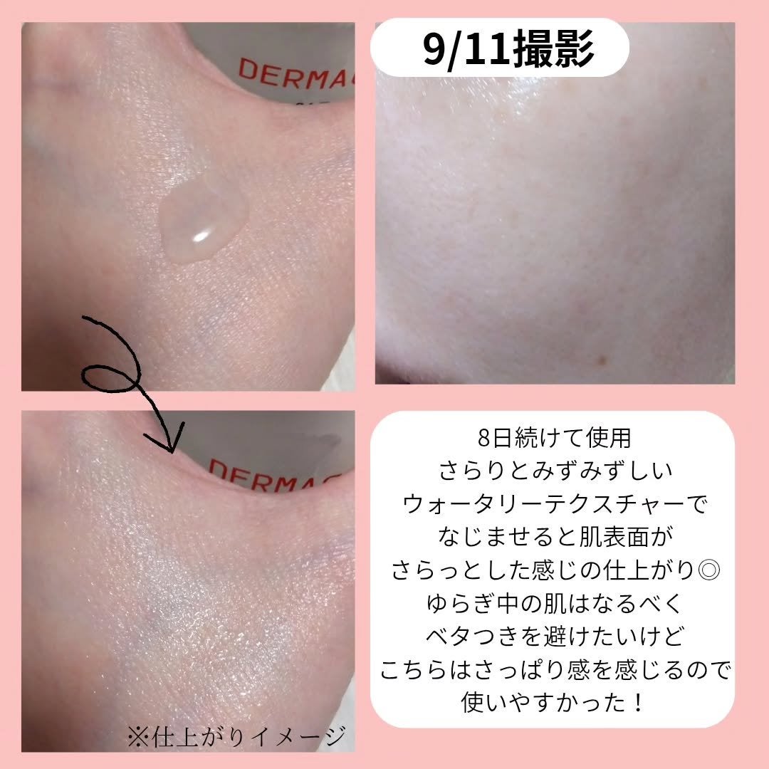 ダーマジェンシー ゼロカ86 トナー/DERMAGENCY/化粧水を使ったクチコミ(3枚目)
