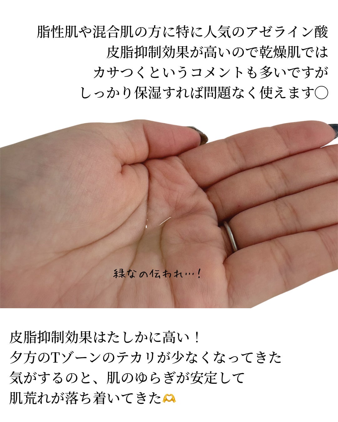 アゼライン酸15 インテンスカーミングセラム/Anua/美容液を使ったクチコミ(3枚目)