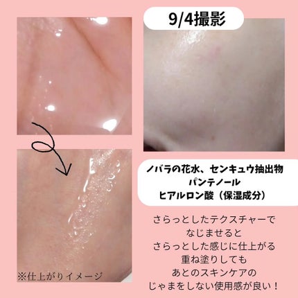 ダーマジェンシー ゼロカ86 トナー/DERMAGENCY/化粧水を使ったクチコミ(2枚目)