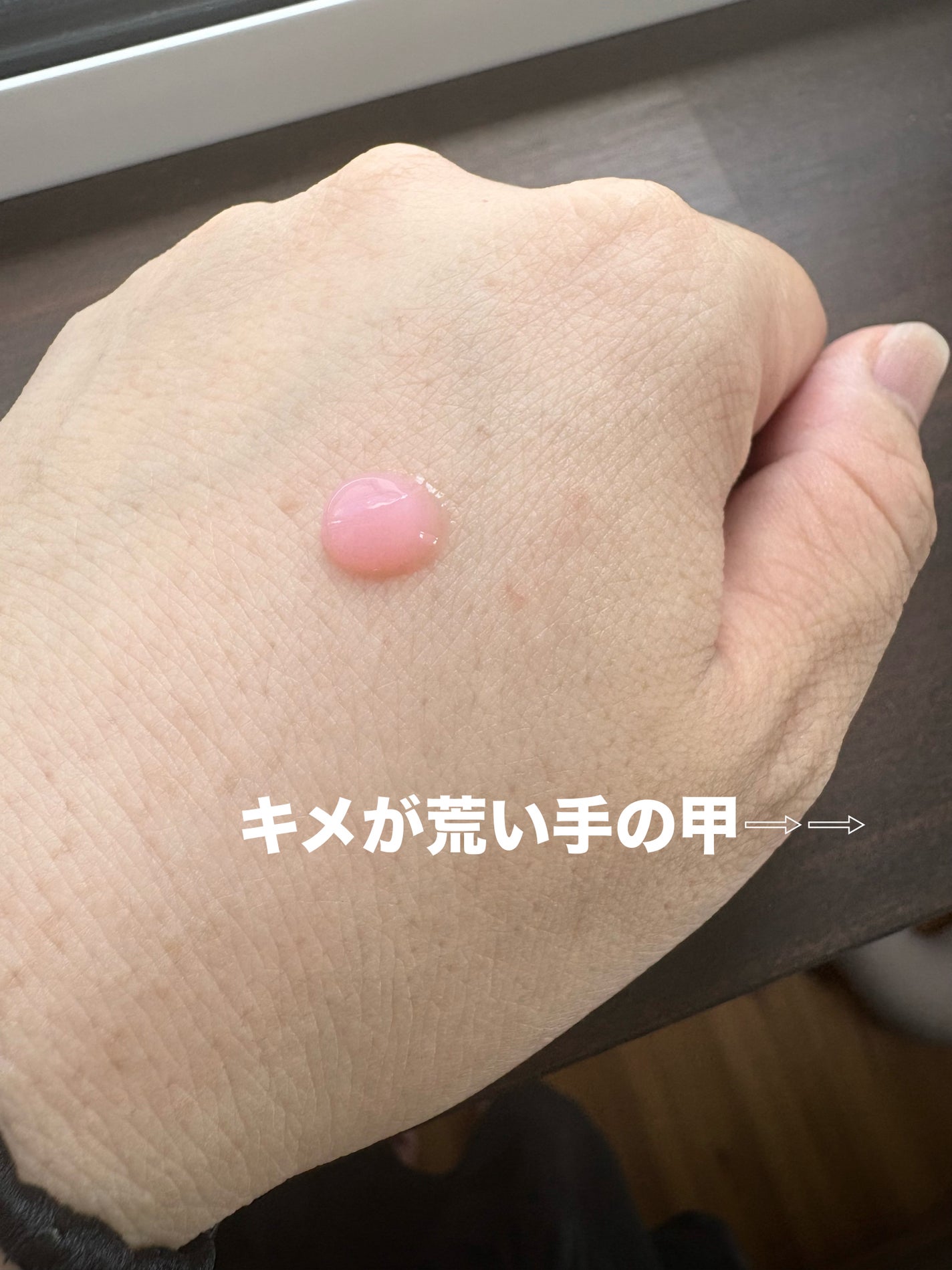 PDRNキューブセラム/DPPR/美容液を使ったクチコミ(3枚目)