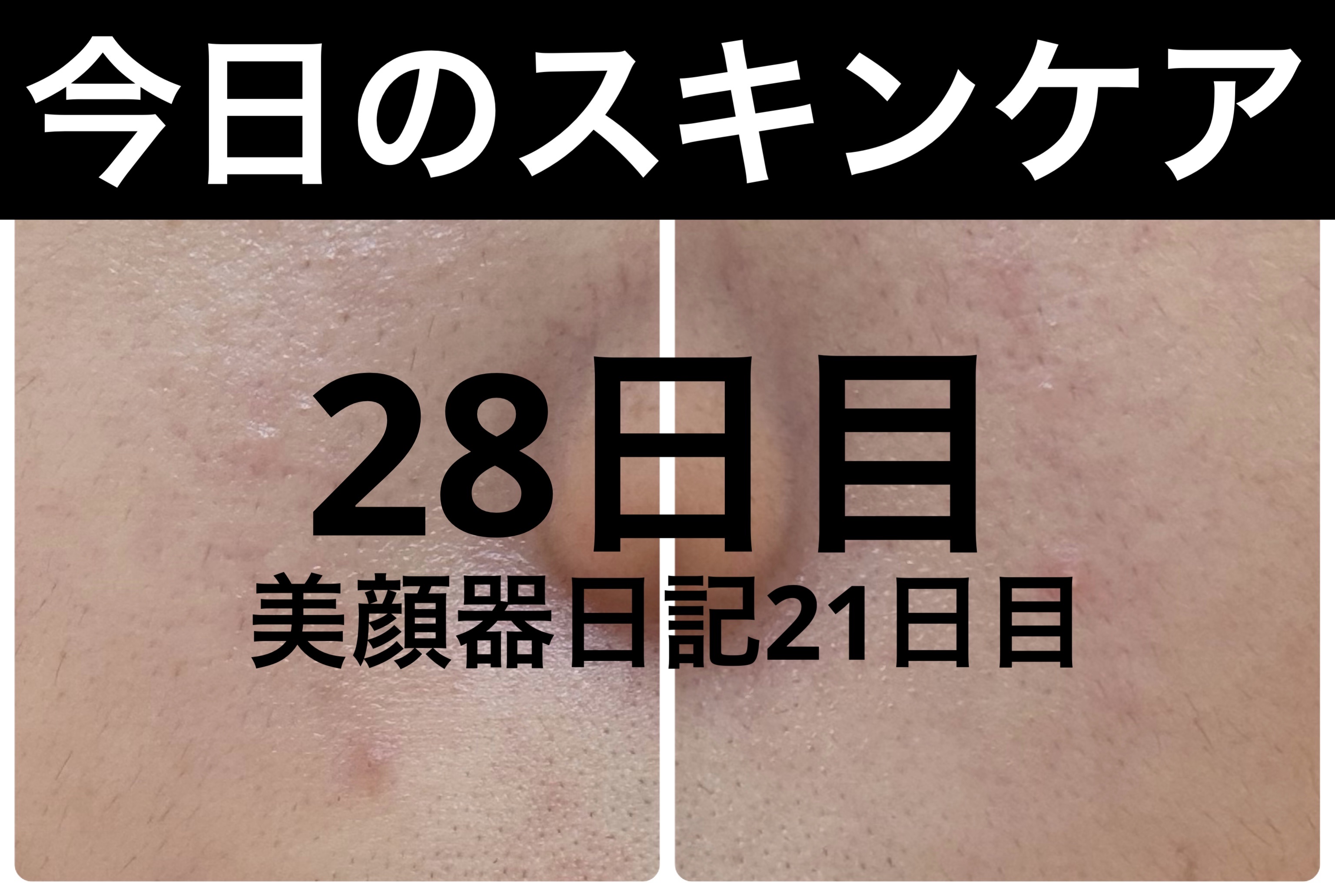 薬用雪肌精 ブライトニング クレンジング オイル[医薬部外品]/雪肌精/オイルクレンジングを使ったクチコミ（1枚目）