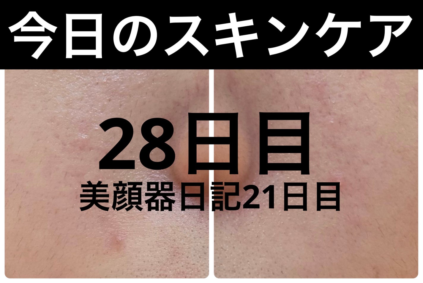 AGE-R ブースタープロ/MEDICUBE/美顔器・マッサージを使ったクチコミ(1枚目)