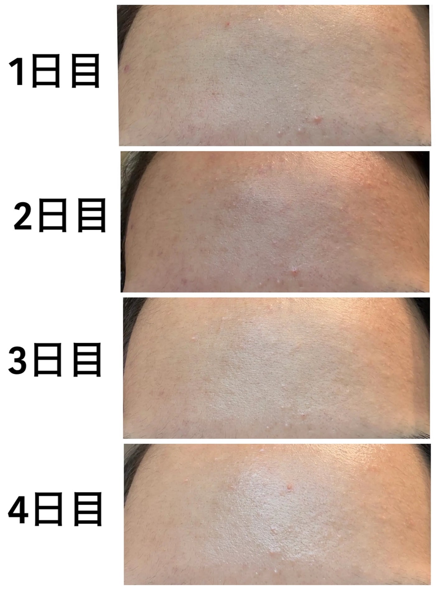 CICA デイリースージングマスク2X/VT/シートマスク・パックを使ったクチコミ(3枚目)