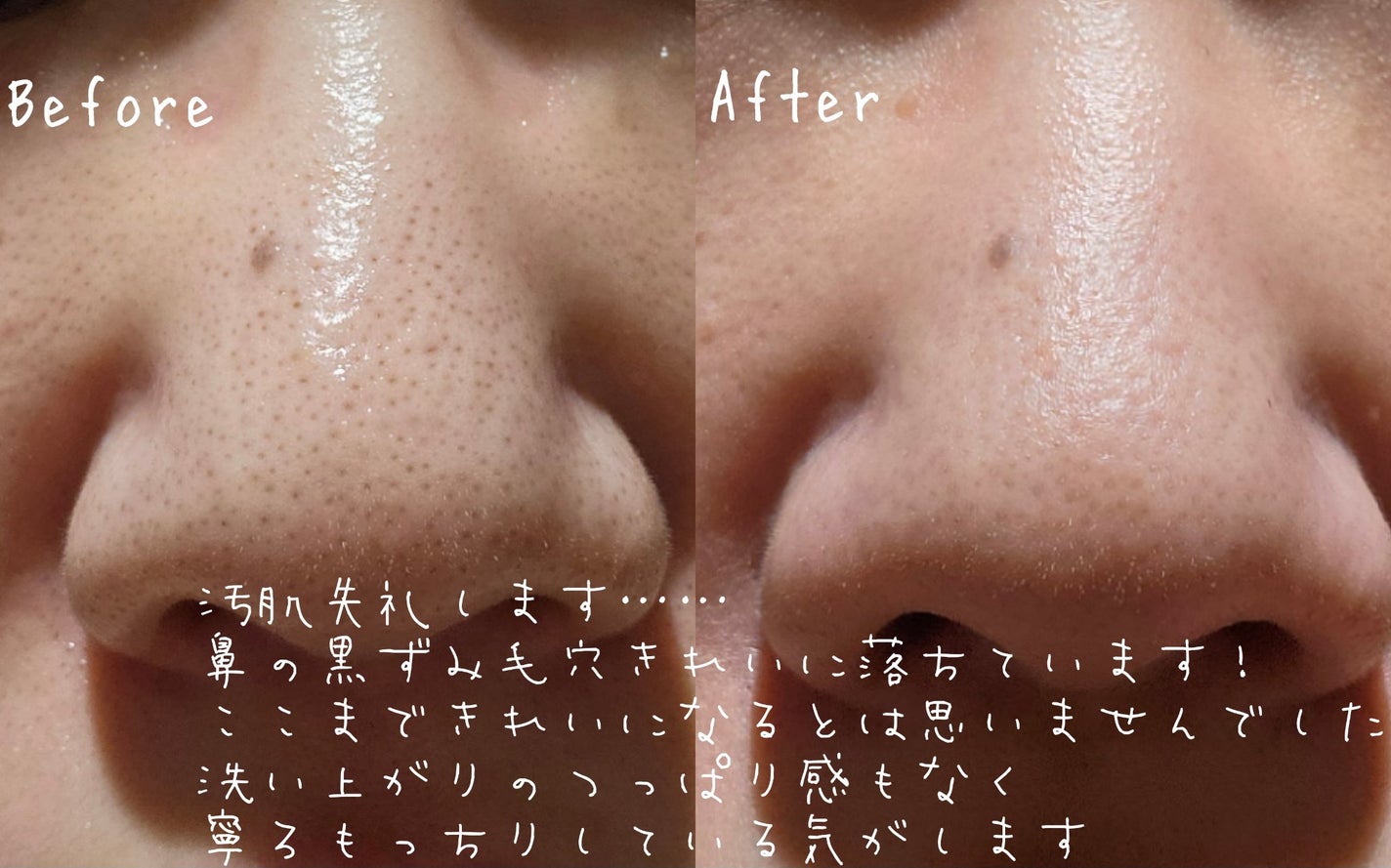 ポアクリア オイル/ONE BY KOSE/オイルクレンジングを使ったクチコミ(5枚目)