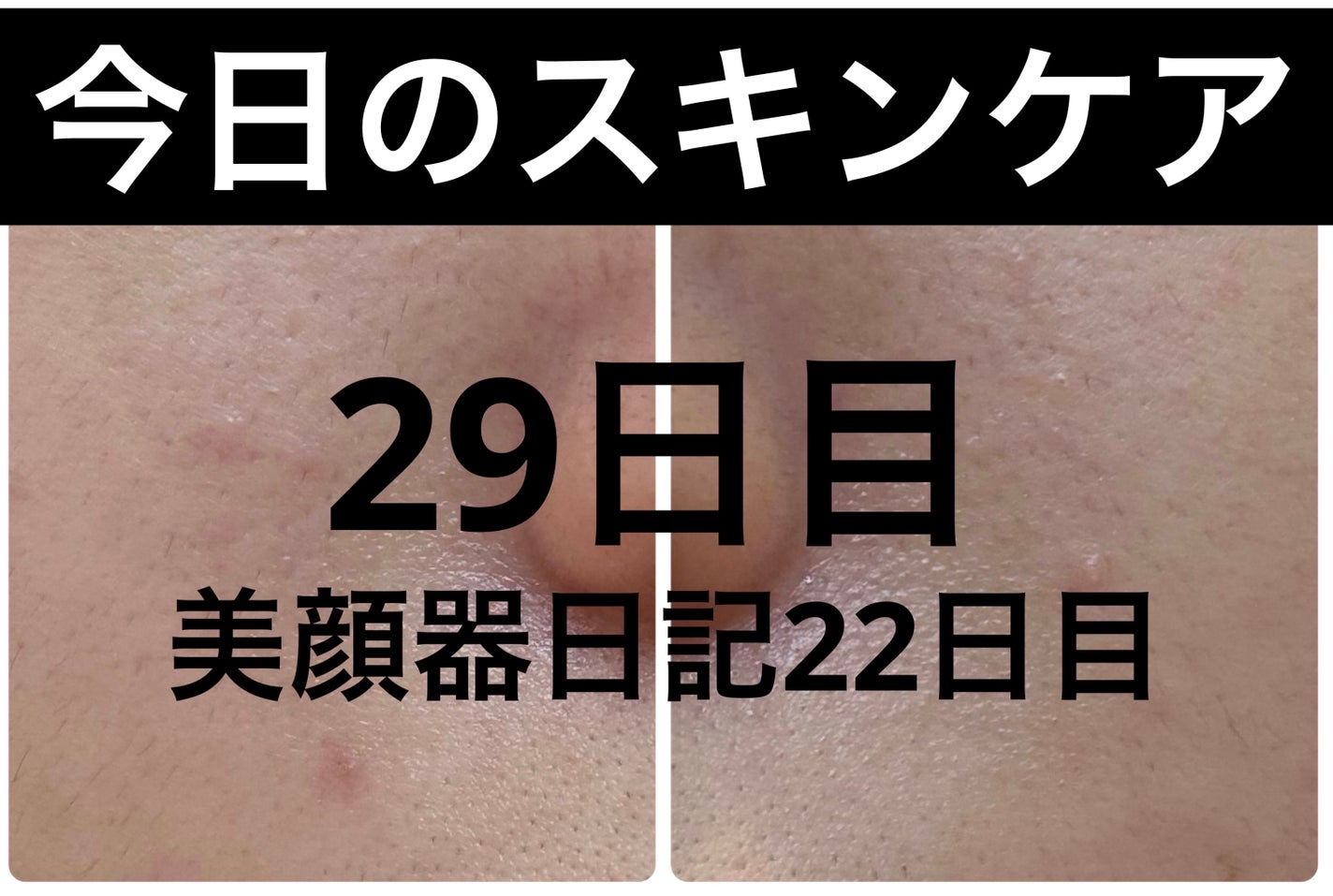 AGE-R ブースタープロ/MEDICUBE/美顔器・マッサージを使ったクチコミ(1枚目)