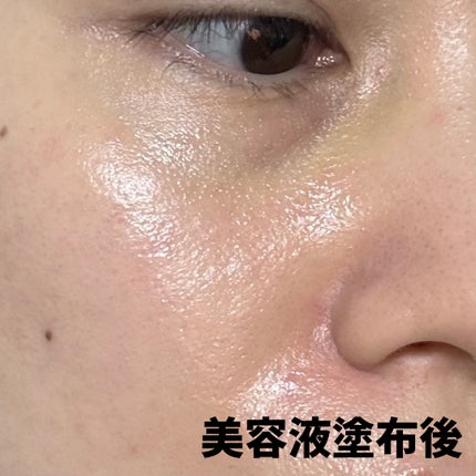 PDRNピンクアンプル PDRN 10,000ppm配合/MEDICUBE/美容液を使ったクチコミ(4枚目)