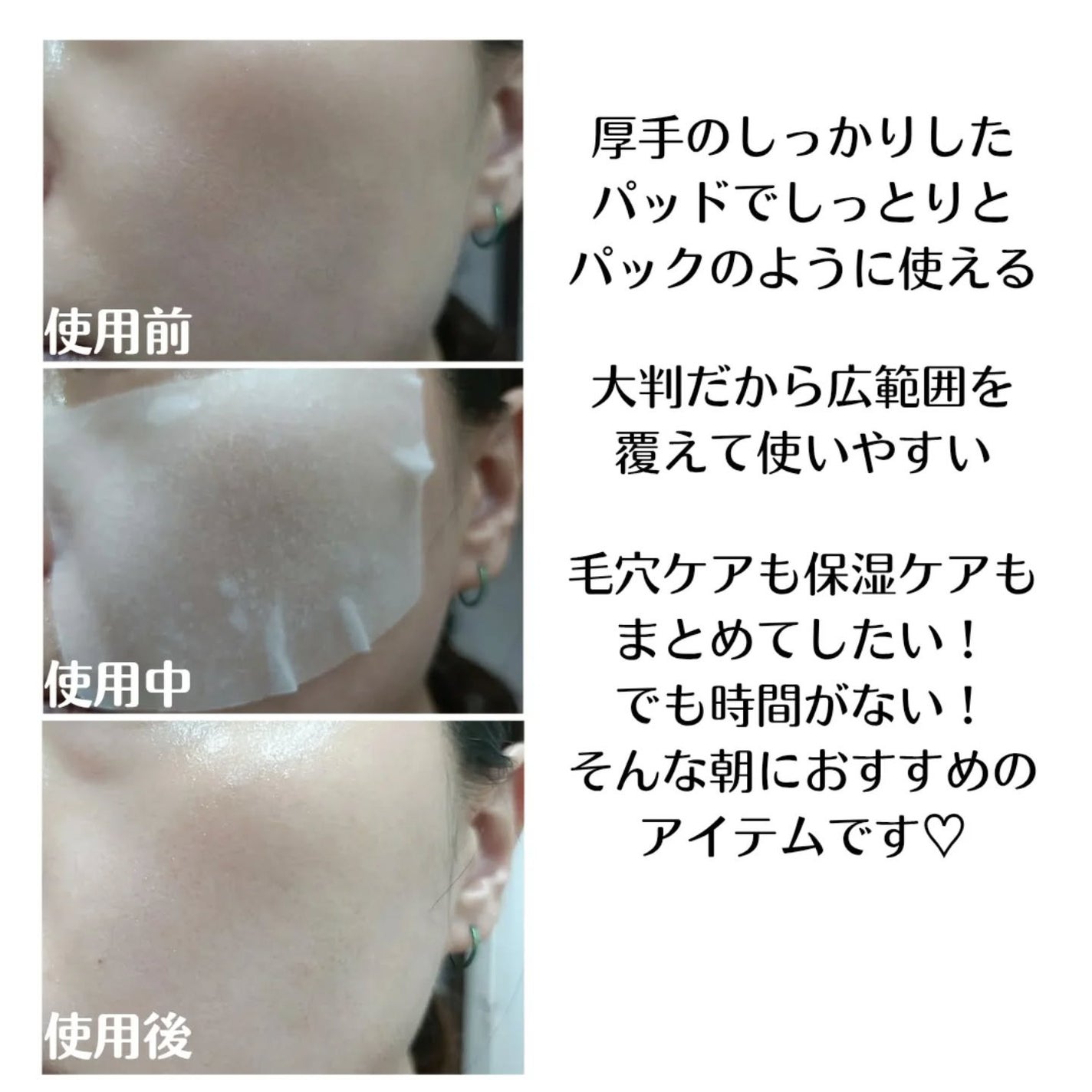 ポアタイトニングトナーパッド/REJURAN COSMETICS/トナーパッドを使ったクチコミ(4枚目)