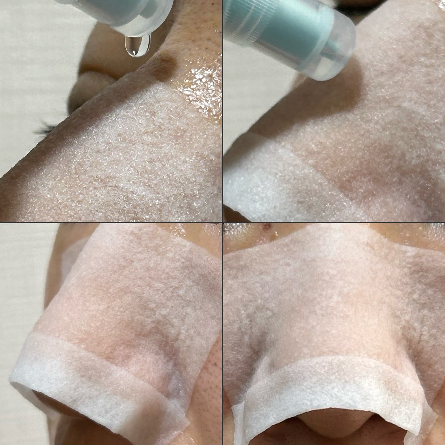 ディープクリーンマスター/ilso/その他スキンケアグッズを使ったクチコミ（2枚目）