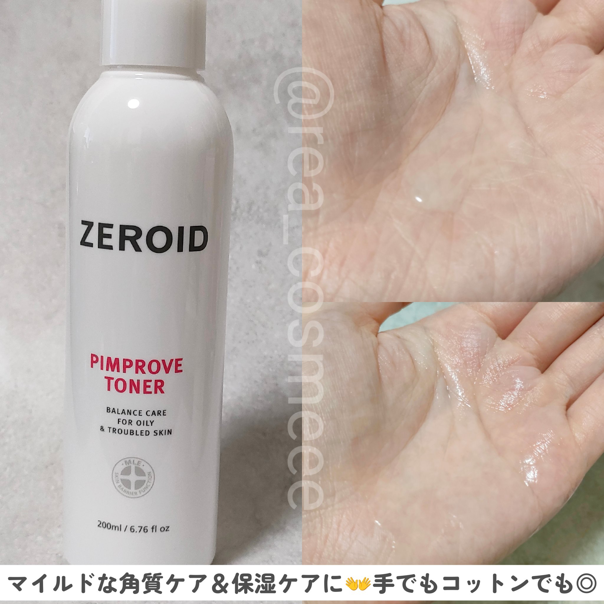 ピンプローブ レッドコントロールクリーム pH4/ZEROID/フェイスクリームを使ったクチコミ（2枚目）