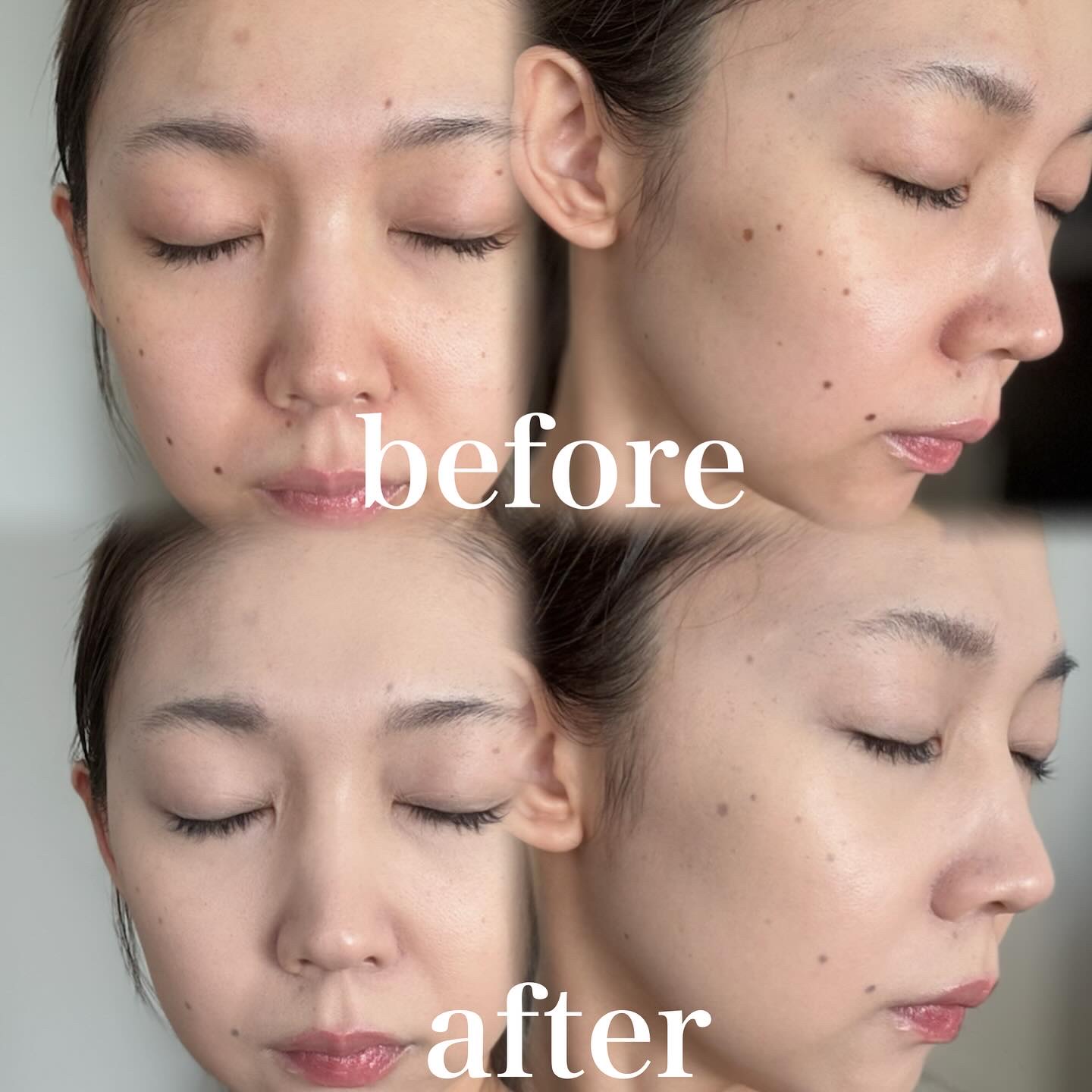 クリーム ファウンデイションe/IPSA/リキッドファンデーションを使ったクチコミ（2枚目）