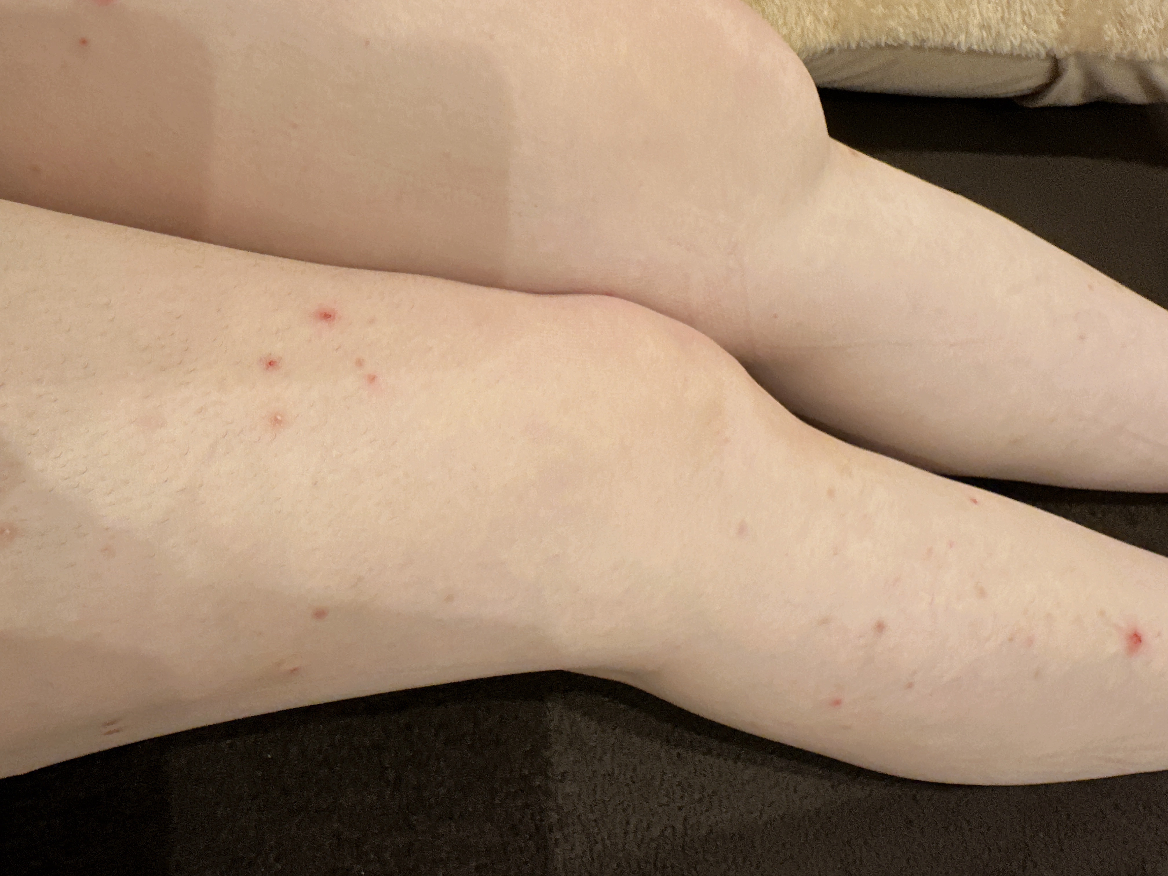 ケアノキュア（医薬品）/小林製薬/その他を使ったクチコミ（2枚目）