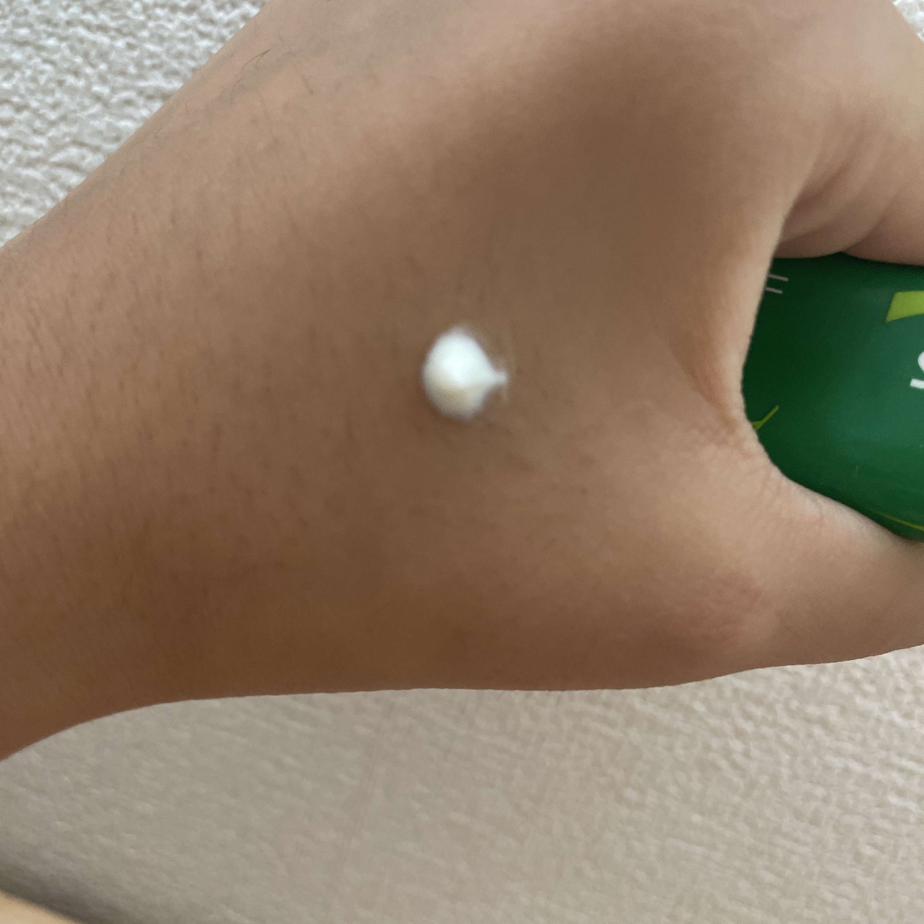 ニキビ治療薬(医薬品)/メンソレータム アクネス/その他を使ったクチコミ（3枚目）