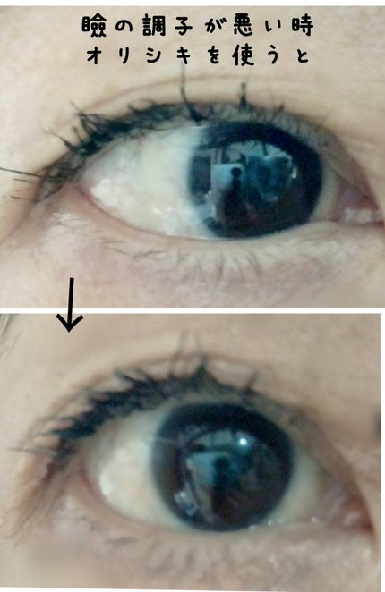 オリシキ アイリッドスキンフィルム /D-UP/二重まぶた用アイテムを使ったクチコミ(2枚目)