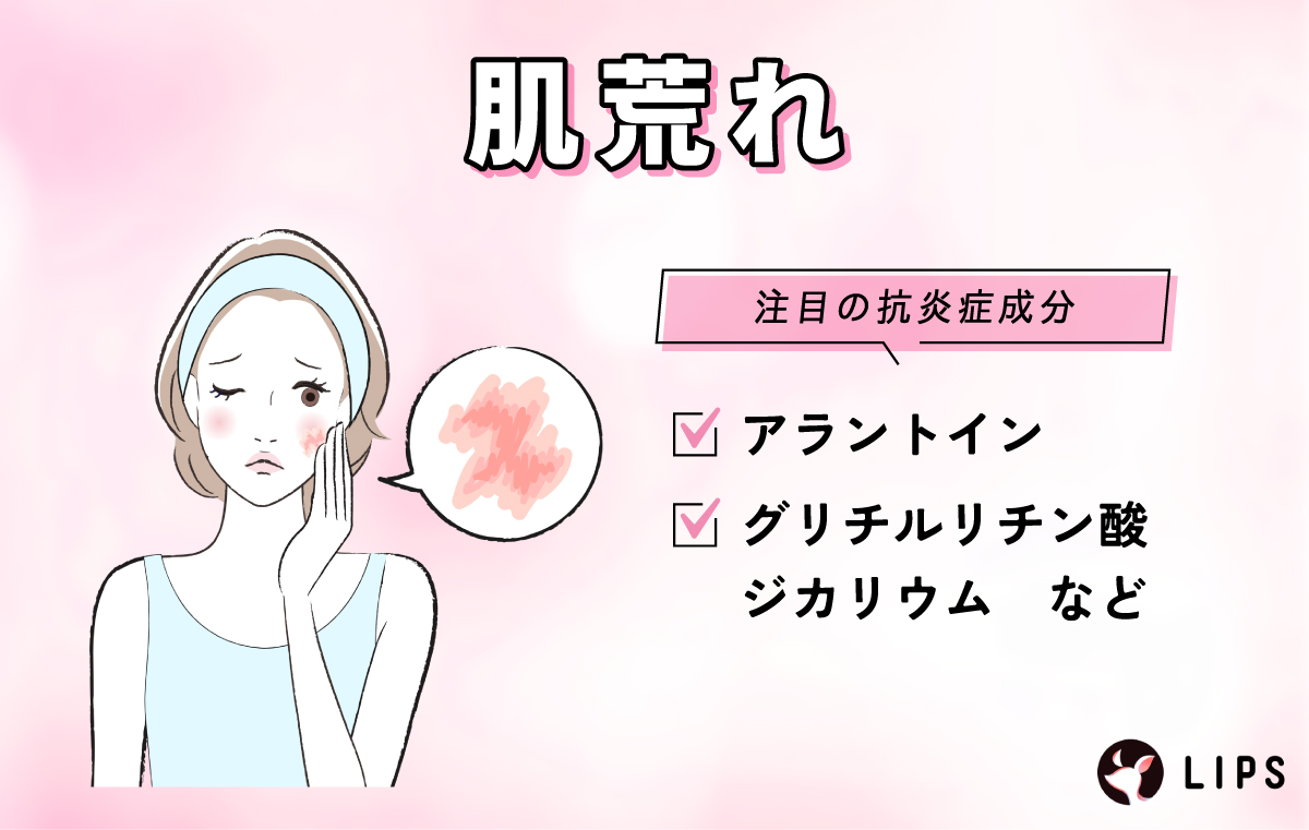 肌荒れの注目の抗炎症成分はアラントインやグリチルリチン酸ジカリウムなど。
