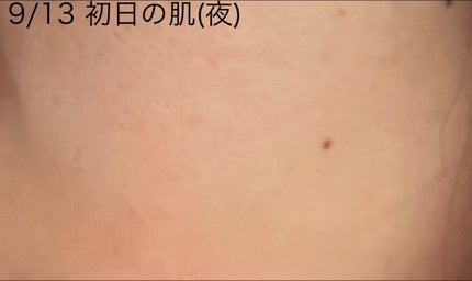 を使ったクチコミ(2枚目)