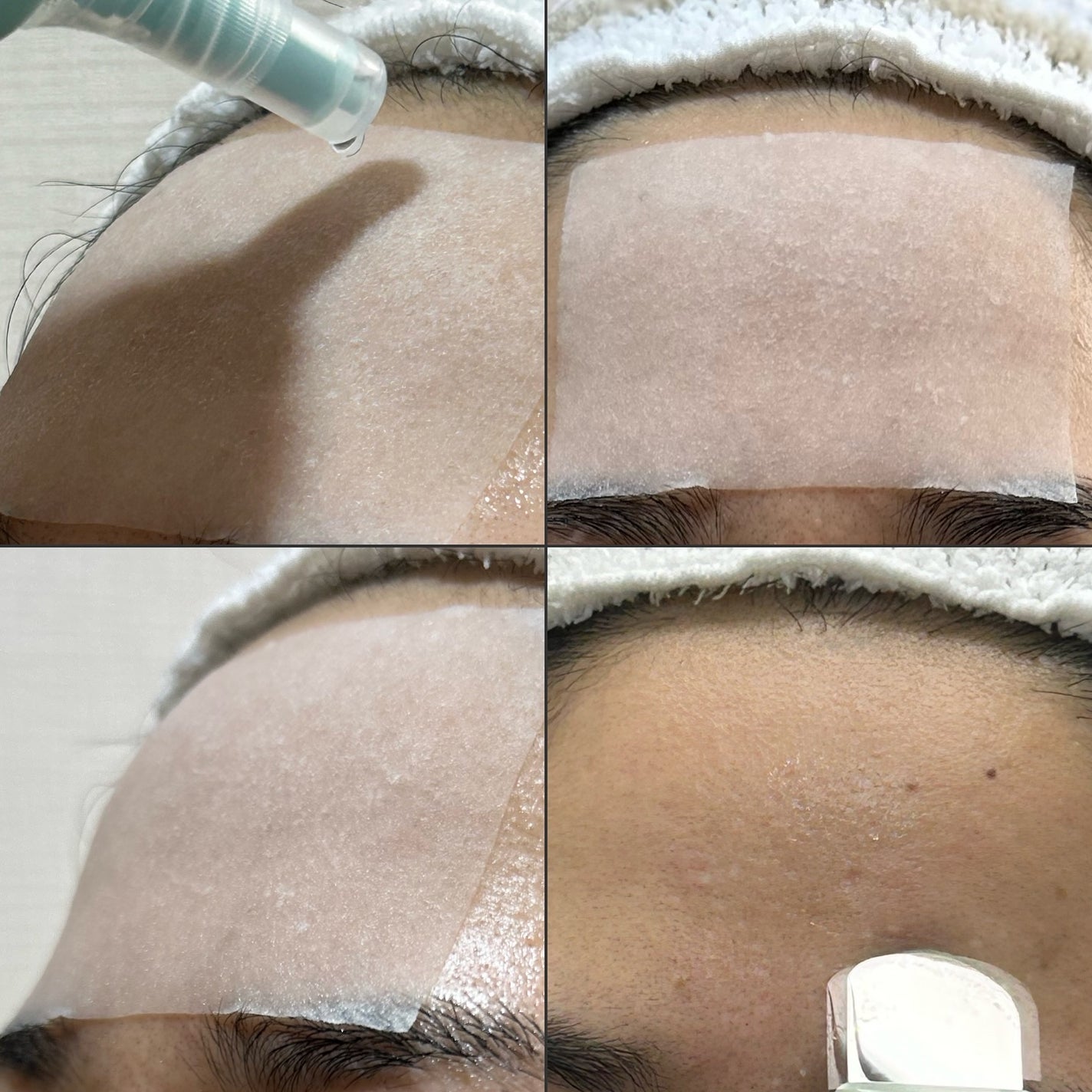 ディープクリーンマスター/ilso/その他スキンケアグッズを使ったクチコミ(3枚目)