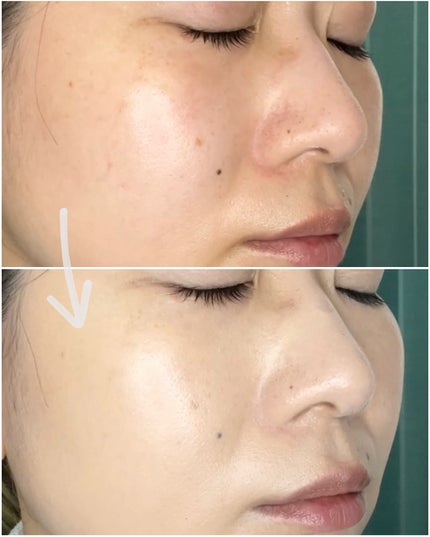 D-クッションファンデーション ホワイトナチュラル/D-RAY/クッションファンデーションの画像