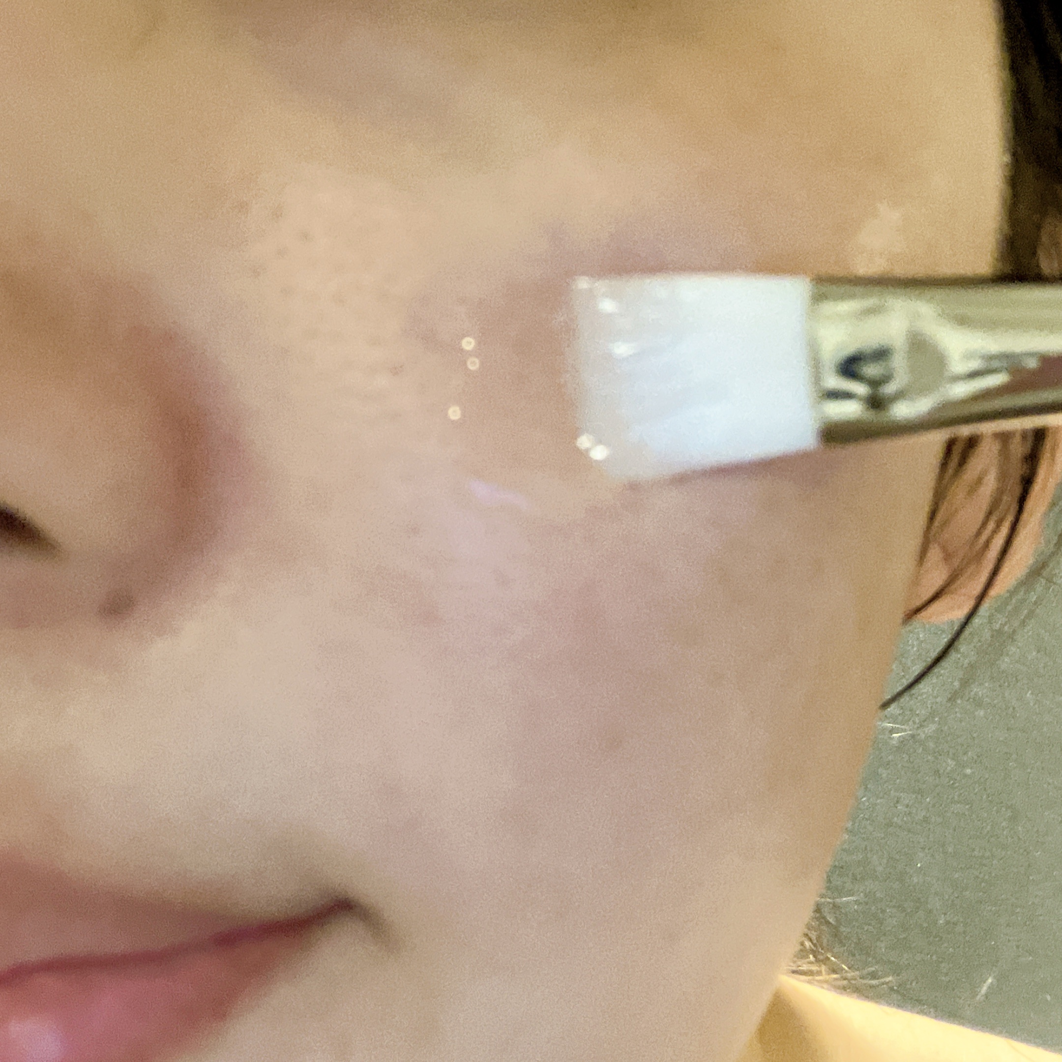 ＭＤピーリングキット II/セラ/ピーリングを使ったクチコミ（3枚目）