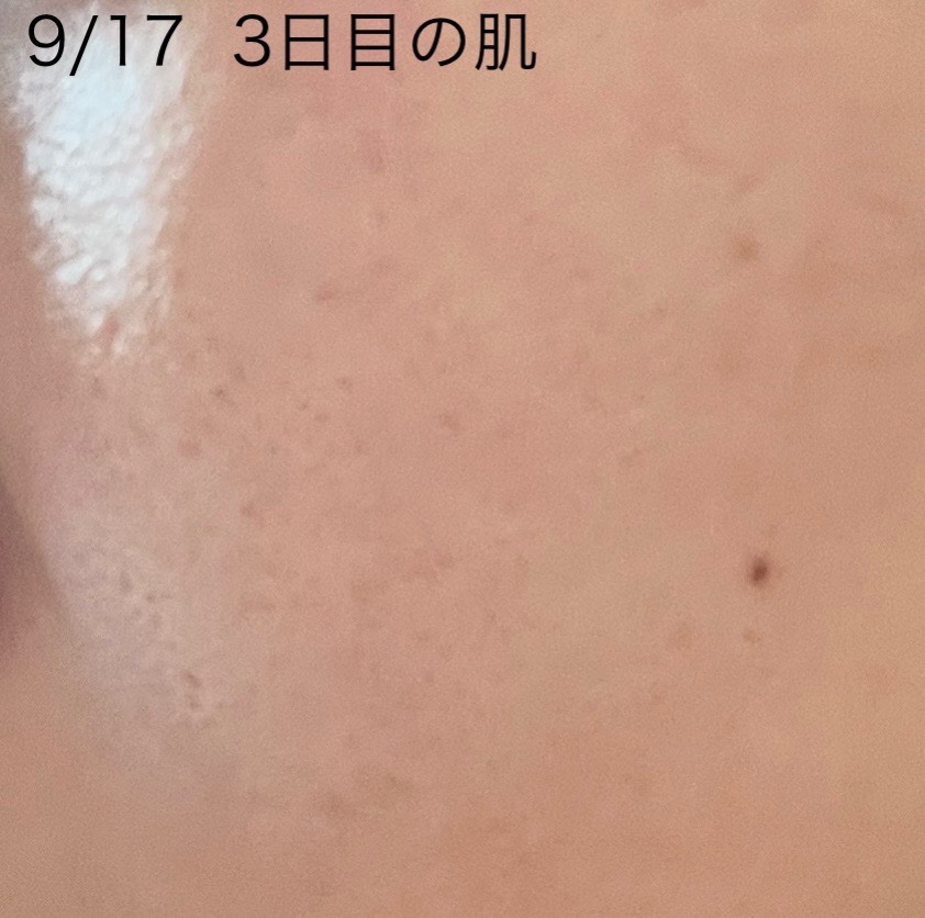 を使ったクチコミ（3枚目）