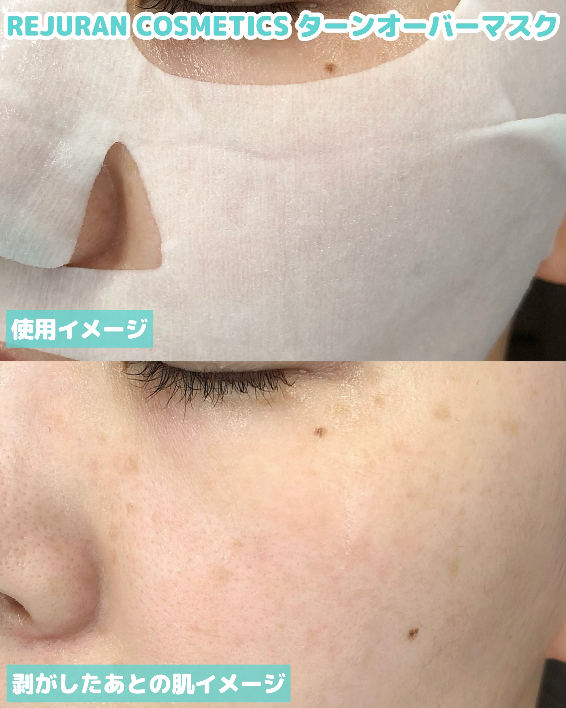 REJURAN ターンオーバーマスク(5枚入り)/REJURAN COSMETICS/シートマスク・パックを使ったクチコミ（3枚目）
