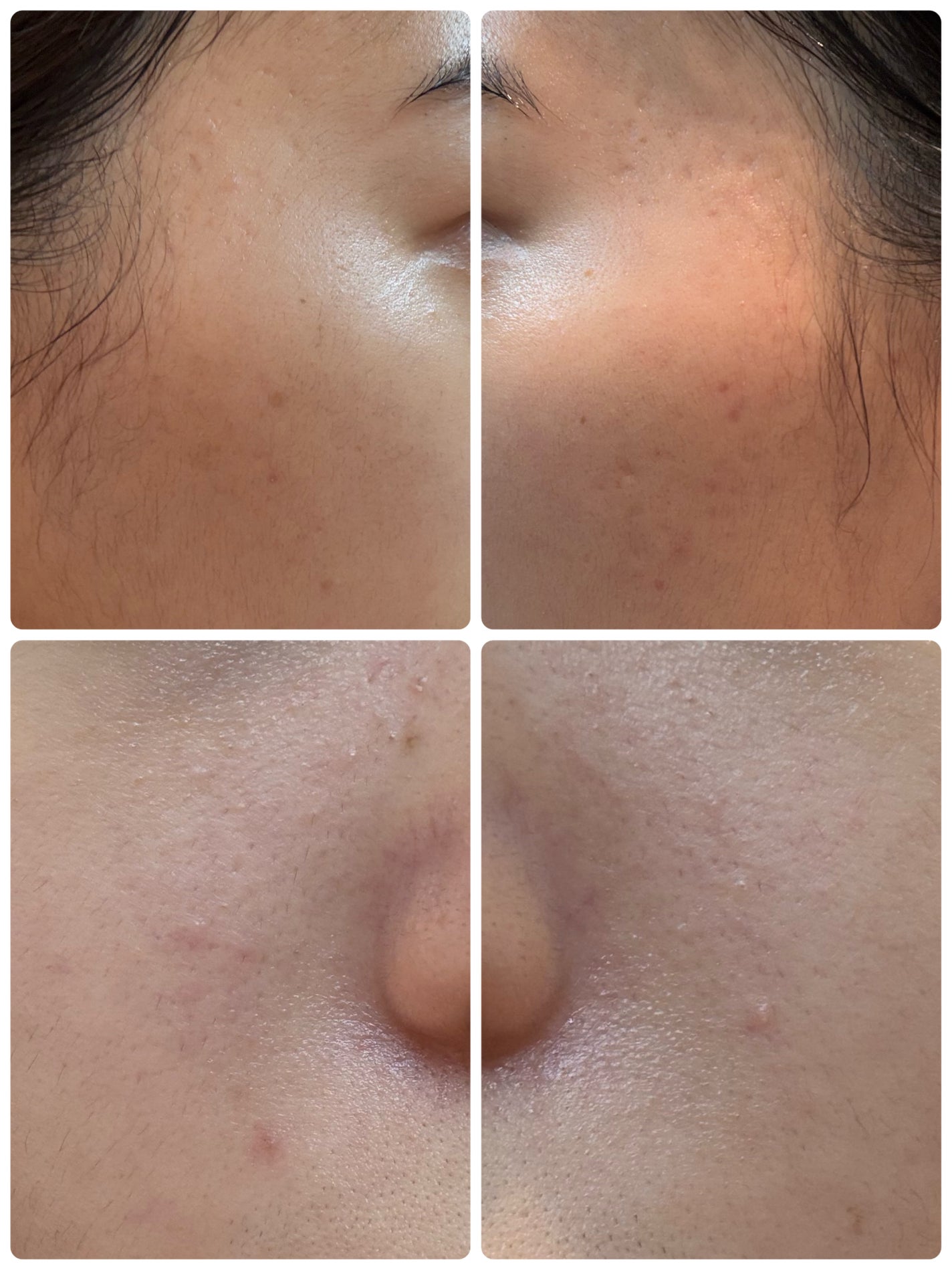 AGE-R ブースタープロ/MEDICUBE/美顔器・マッサージを使ったクチコミ(2枚目)