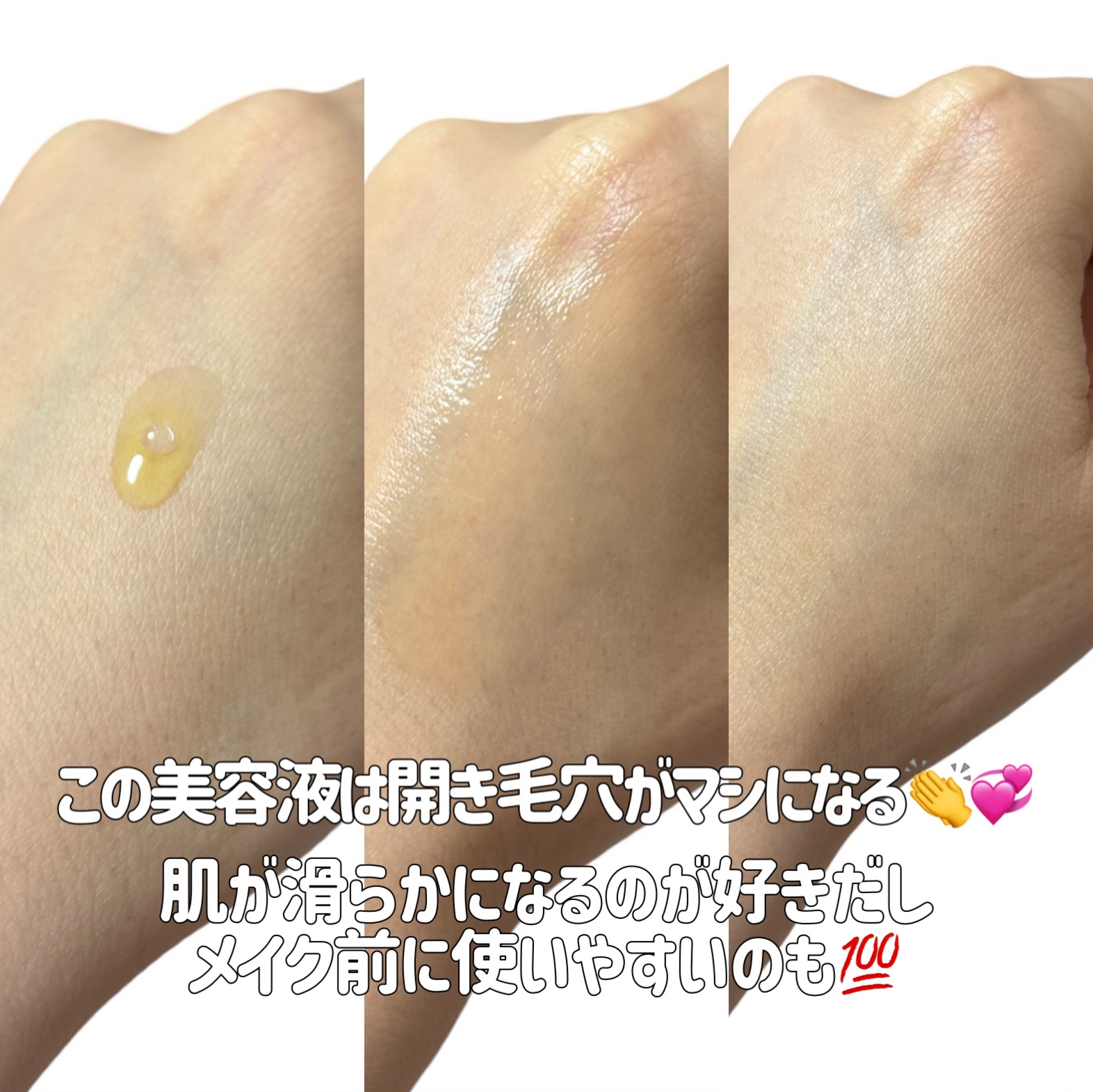 オバジC10セラム/オバジ/美容液を使ったクチコミ（3枚目）