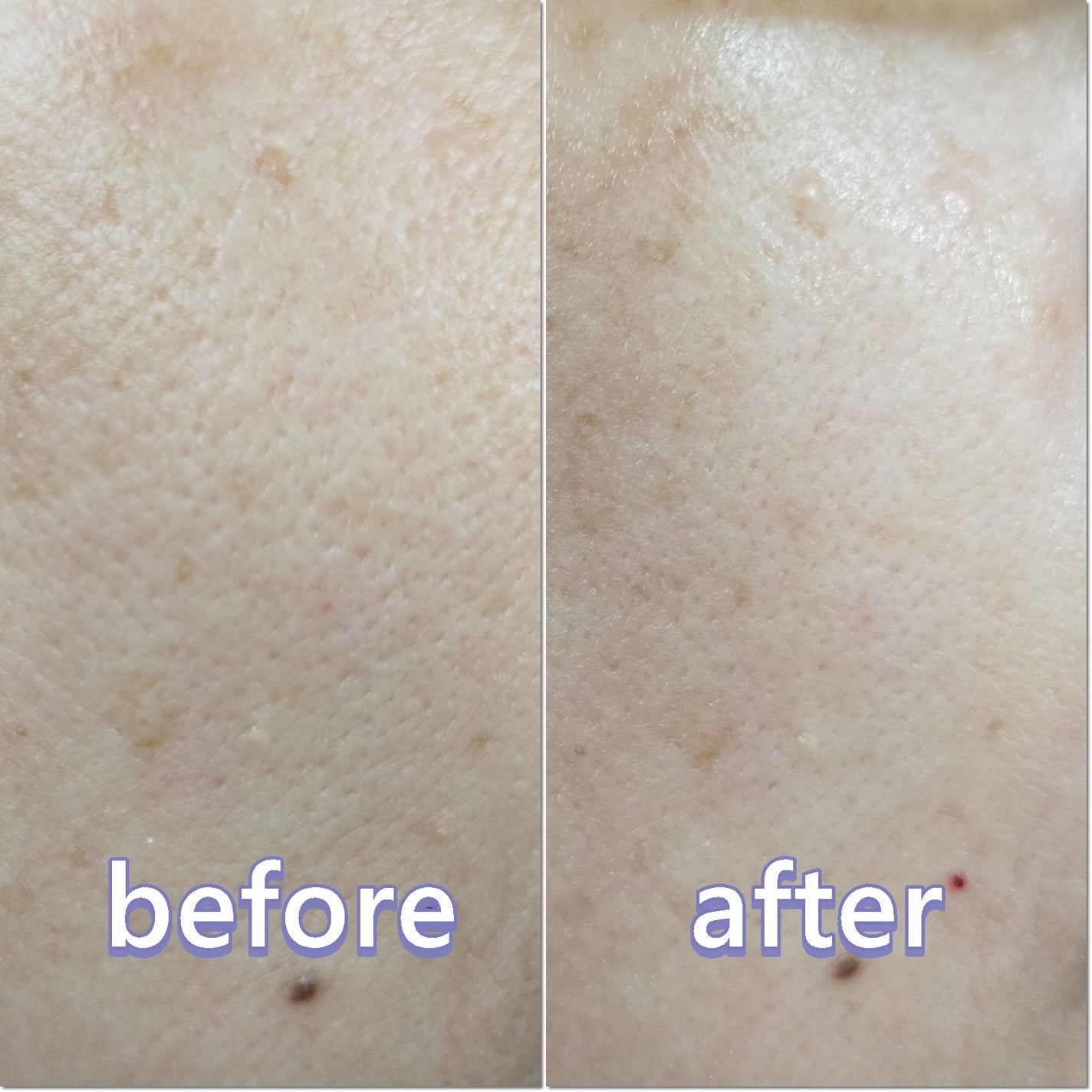 ポアタイトニングトナーパッド/REJURAN COSMETICS/トナーパッドを使ったクチコミ(4枚目)