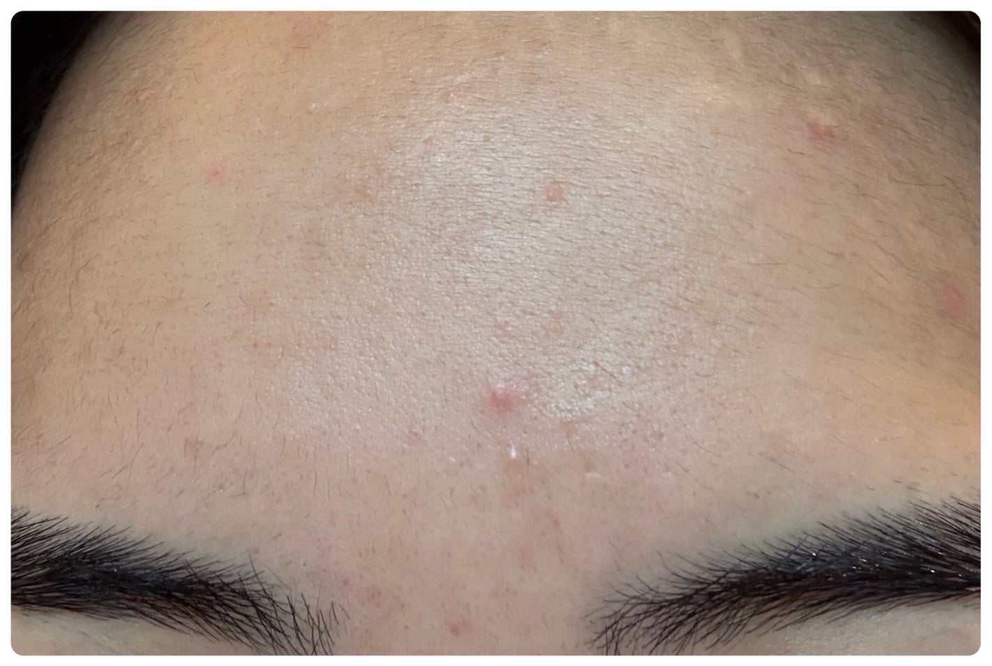 AGE-R ブースタープロ/MEDICUBE/美顔器・マッサージを使ったクチコミ(3枚目)