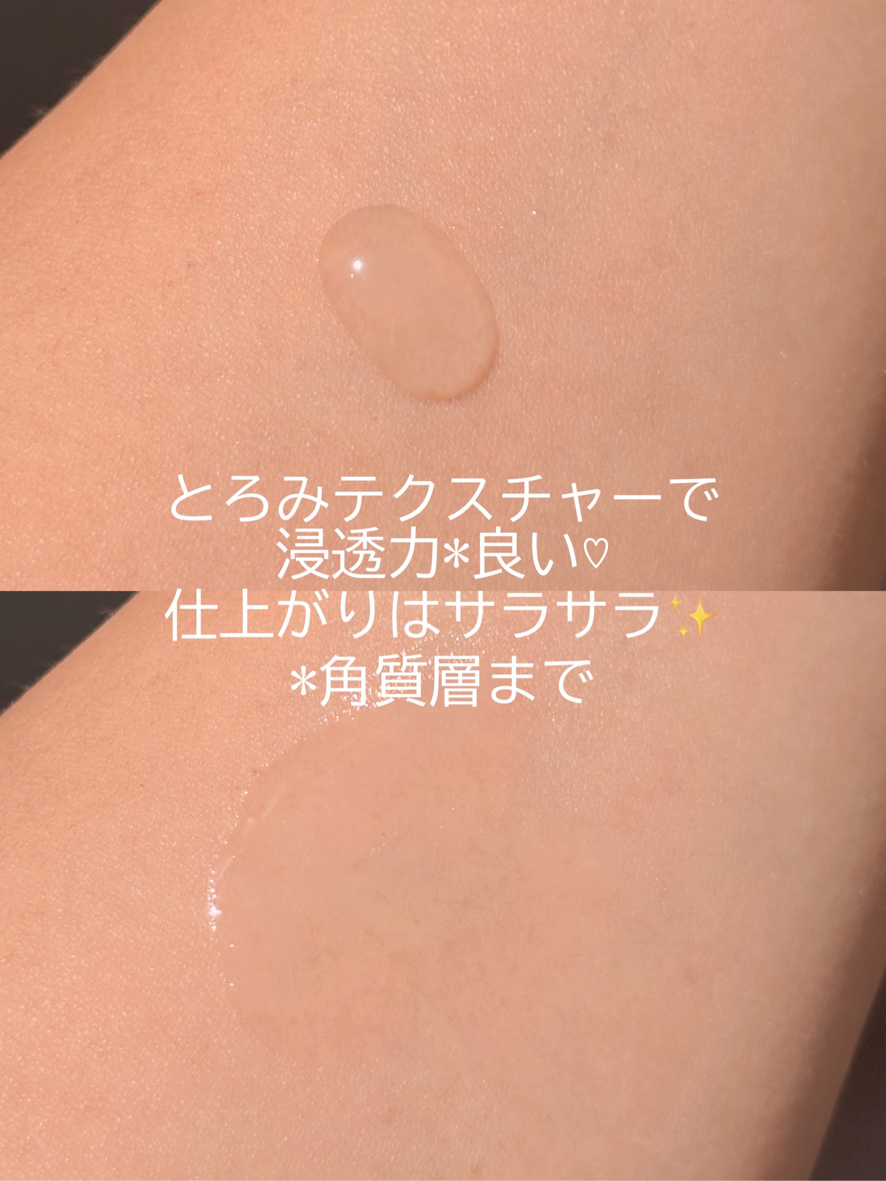 バイオスキンエッセンスプラス/Bionist (ビオニスト)/美容液を使ったクチコミ（3枚目）