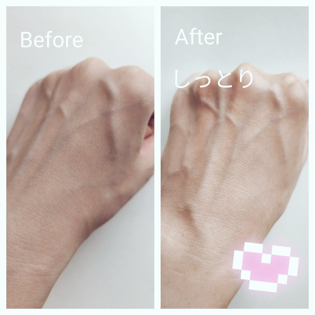 コラーゲンバウンスアップハイパーアクティブゲルマスク/SNP/シートマスク・パックを使ったクチコミ（3枚目）