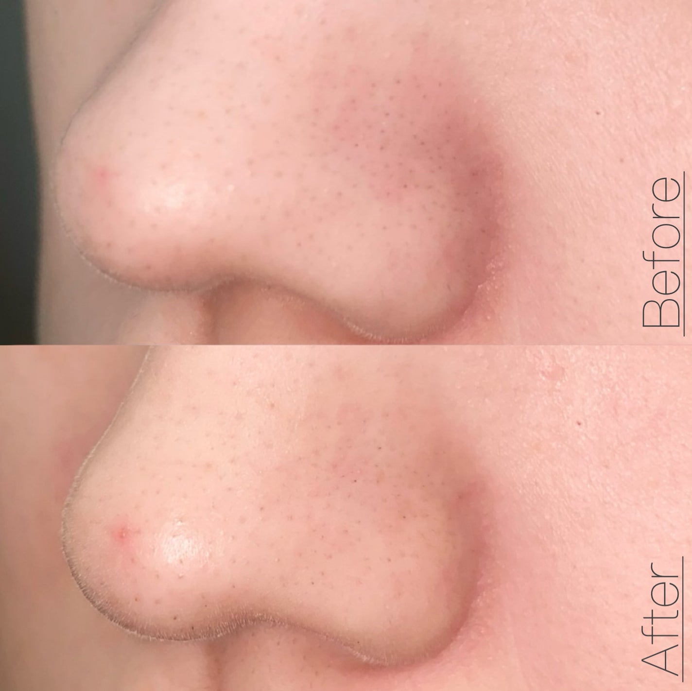 ニベア2WAY美容洗顔 AC/ニベア/洗顔フォームを使ったクチコミ(6枚目)