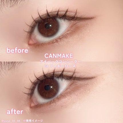 アイバッグコンシーラー/キャンメイク/ペンシルコンシーラーを使ったクチコミ(6枚目)