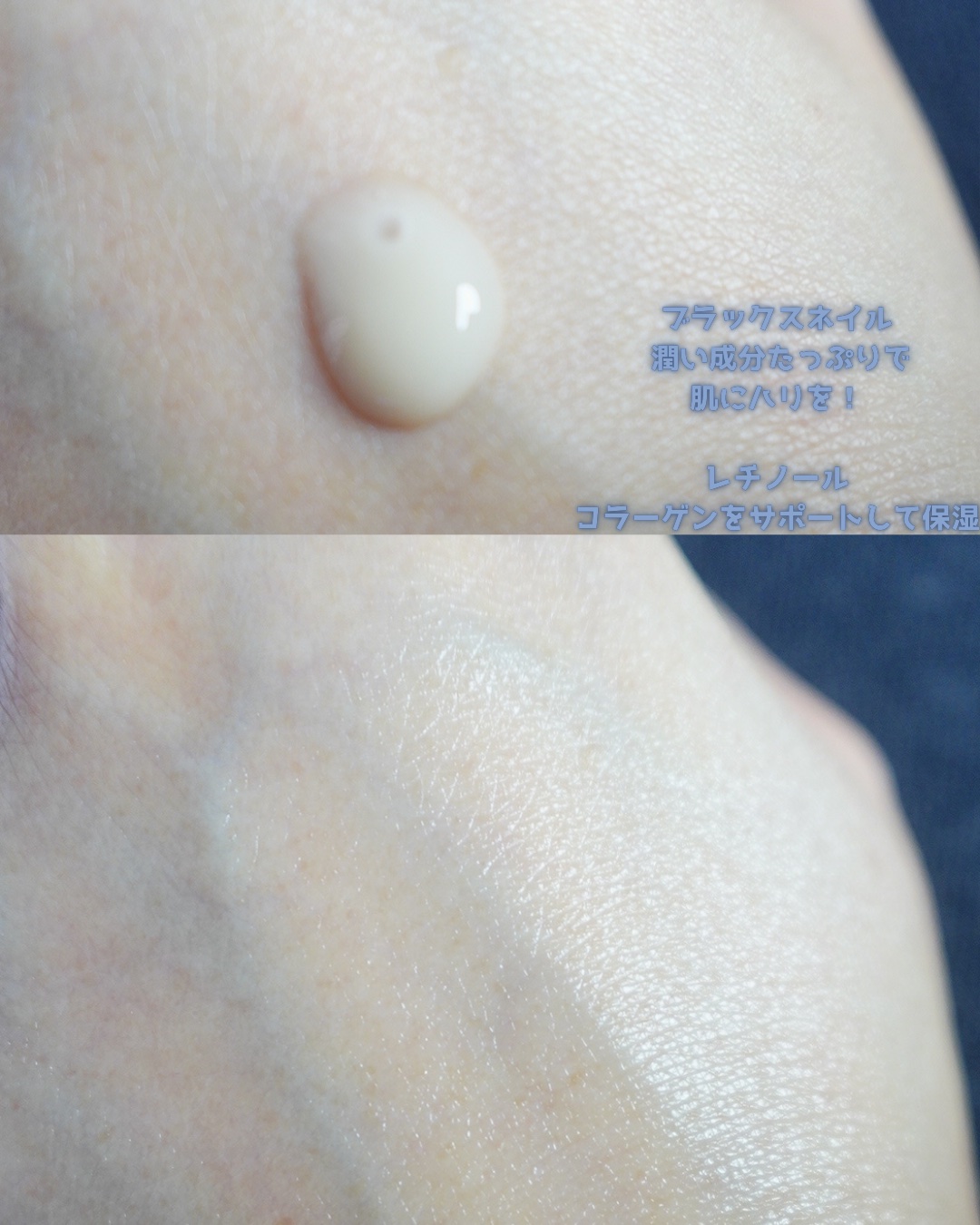 ブラックスネイルレチノールセラム/Dr.G/美容液を使ったクチコミ（3枚目）