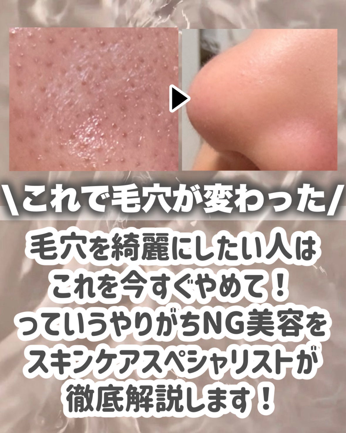 ロゼットゴマージュ/ロゼット/ピーリングを使ったクチコミ(2枚目)