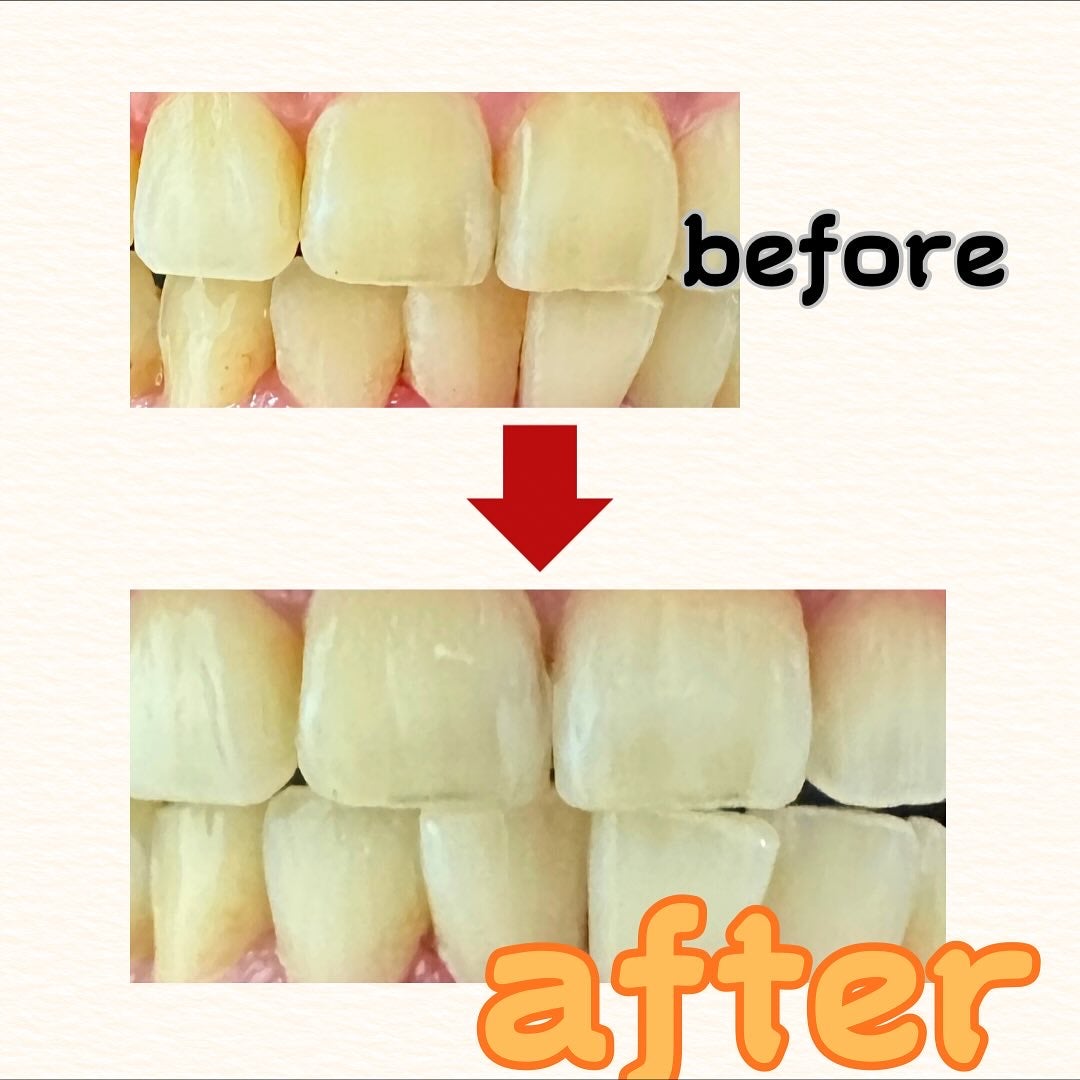 茶々丸 on LIPS 「オーラツーさんから出ている週1のスペシャル美白ケア!私は週1で..」(2枚目)